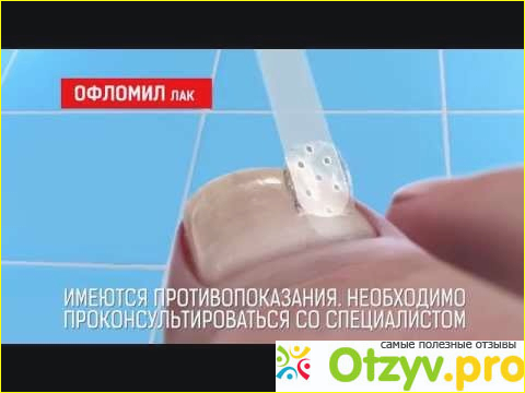 Как действует оflomil лак для ногтей