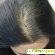Фотохромотерапия восстановит волосы -  - Фото 239155