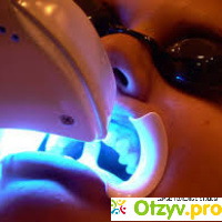 Лазерная чистка зубов отзывы