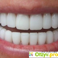 Полоски для отбеливания зубов 3d white отзывы