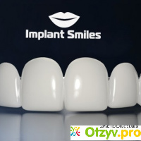 Implant Smiles - съемные виниры отзывы