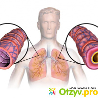 Традиционное лечение бронхиальной астмы отзывы