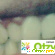 Чистка зубов ультразвуком - Чистка и пилинг - Фото 32051