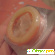 Презерватив с шипами - Презервативы - Фото 143938
