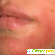 Аллергия на лице -  - Фото 185168