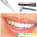 Tooth whitening -  - Фото 283862