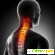 Болит спина, причины, симптомы и лечение болей в спине -  - Фото 365602
