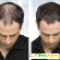 Загуститель волос для мужчин Caboki: свойства, отзывы -  - Фото 361593