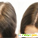 Head &Hair комплекс для волос Здоров -  - Фото 431870
