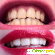 Oxy для отбеливания зубов: цена, отзывы, купить -  - Фото 421942