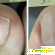 Clean Forte от грибка ногтей и стоп: цена, отзывы, купить -  - Фото 423831