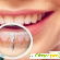 Одноэтапная имплантация зубов отзывы отрицательные -  - Фото 497117