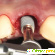 Одноэтапная имплантация зубов отзывы отрицательные -  - Фото 497116