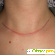 Удаление щитовидной железы отзывы форум -  - Фото 499827