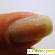 Zinger nail repair -  - Фото 520683