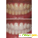 Отбеливание зубов отзывы фото до и после -  - Фото 586476