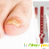 Нафтифин от грибка ногтей отзывы цена -  - Фото 658920