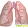 Воспаление лёгких симптомы -  - Фото 647254