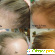 Миноксидил для волос отзывы женщин -  - Фото 745899
