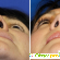 Септопластика носа: разновидности и особенности -  - Фото 821088