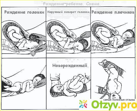 Как проходят естественные роды