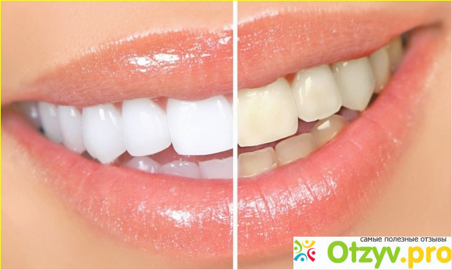 Отбеливание чайным деревом.