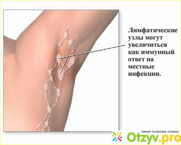 Лимфоузлы под мышкой где находятся схема