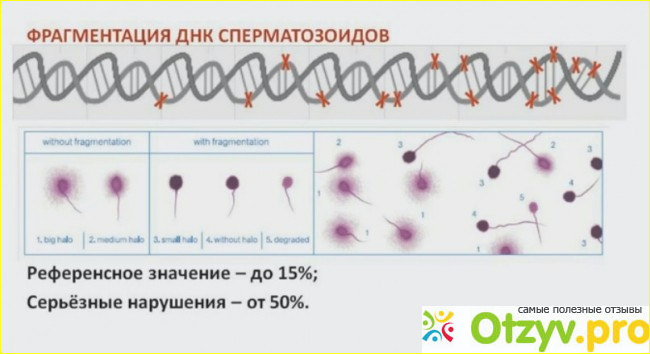 Днк 26. Средняя степень фрагментации ДНК спермограммы. Оценка фрагментации ДНК сперматозоидов. Фрагментация ДНК спермограммы норма. Нормальные показатели фрагментации ДНК сперматозоидов.