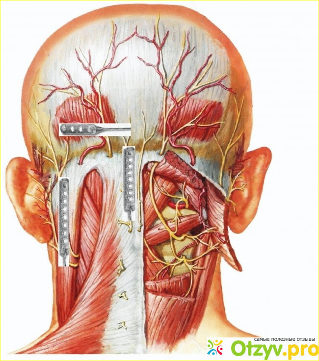 Невралгия затылочного нерва: лечение, симптомы и причины