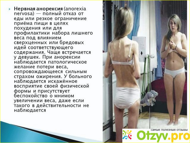 Психогенное переедание