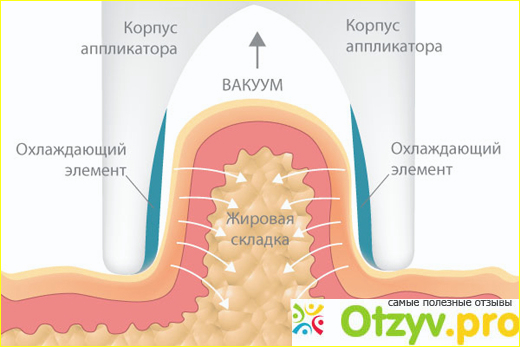 Противопоказания: 