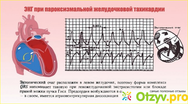  Продуктивный препарат, который регулирует сердечные ритмы. 