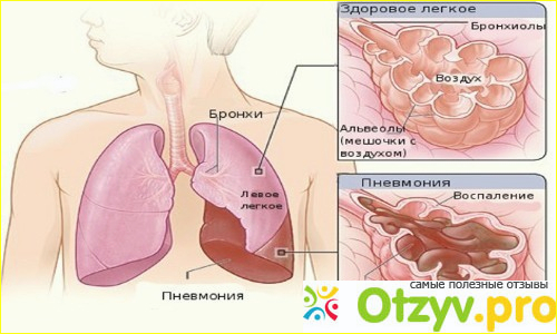 Коробка от лекарства и само лекарство внутри. 