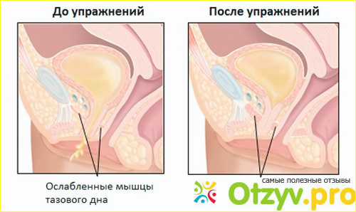 Упражнения Кегеля