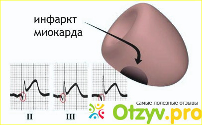 Отзыв о Скорая помощь.