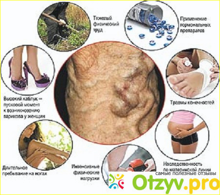 Где можно Cream Of Varicose Veins купить