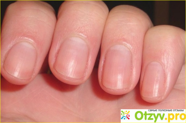 Ремувер что это фото4