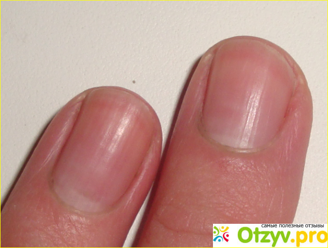 Ремувер что это фото1