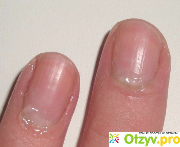 Ремувер что это фото2