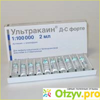 Отзыв о Ультракаин Dс Форте