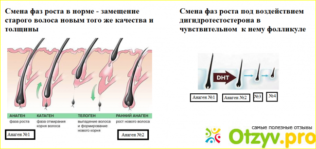 Миноксидил противопоказания 