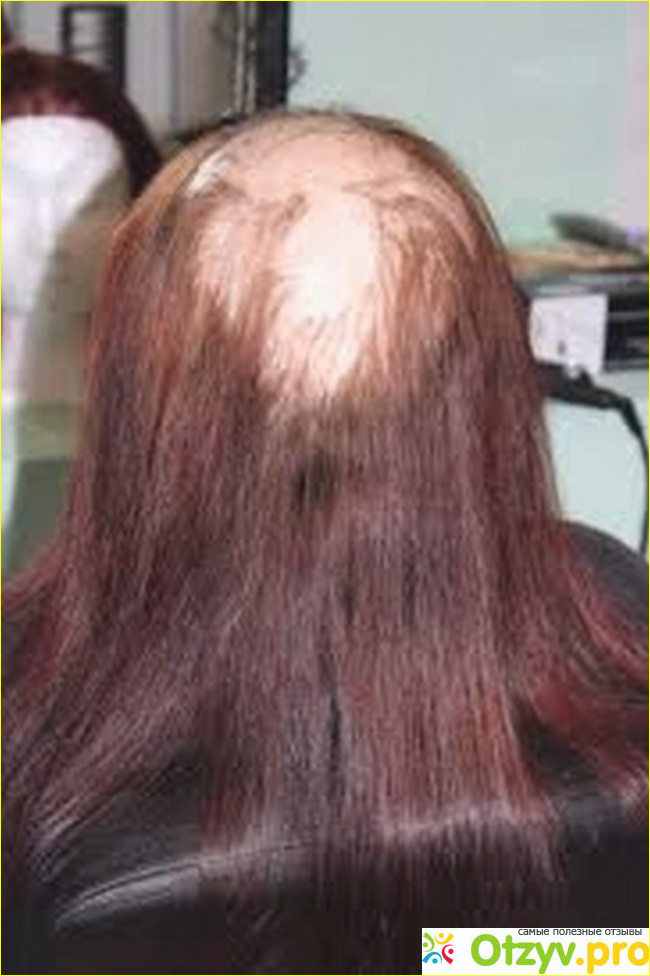 Наращивание волос последствия фото фото1