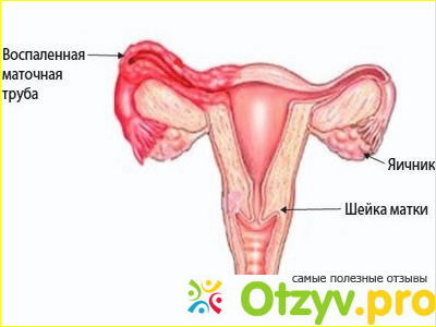 Отзыв о Узи маточных труб на проходимость