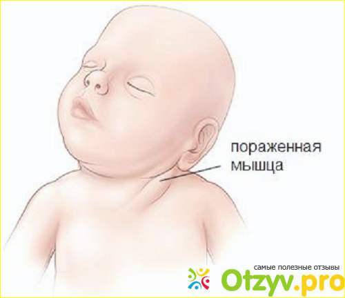 Отзыв о Новорожденный много срыгивает после кормления