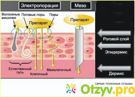 Электропорация фото1