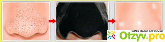 Где можно маску от прыщей и черных точек Black Mask купить: цена и официальный сайт