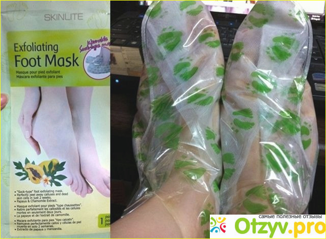 Применение отшелушивающей маски для ног Skinlite