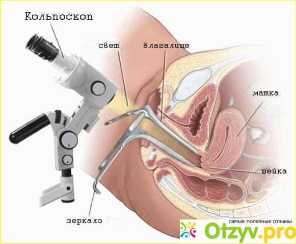 Как проводится исследование