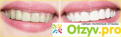 Tooth whitening gel инструкция по применению