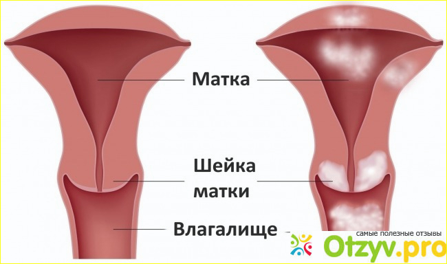 Профилактика